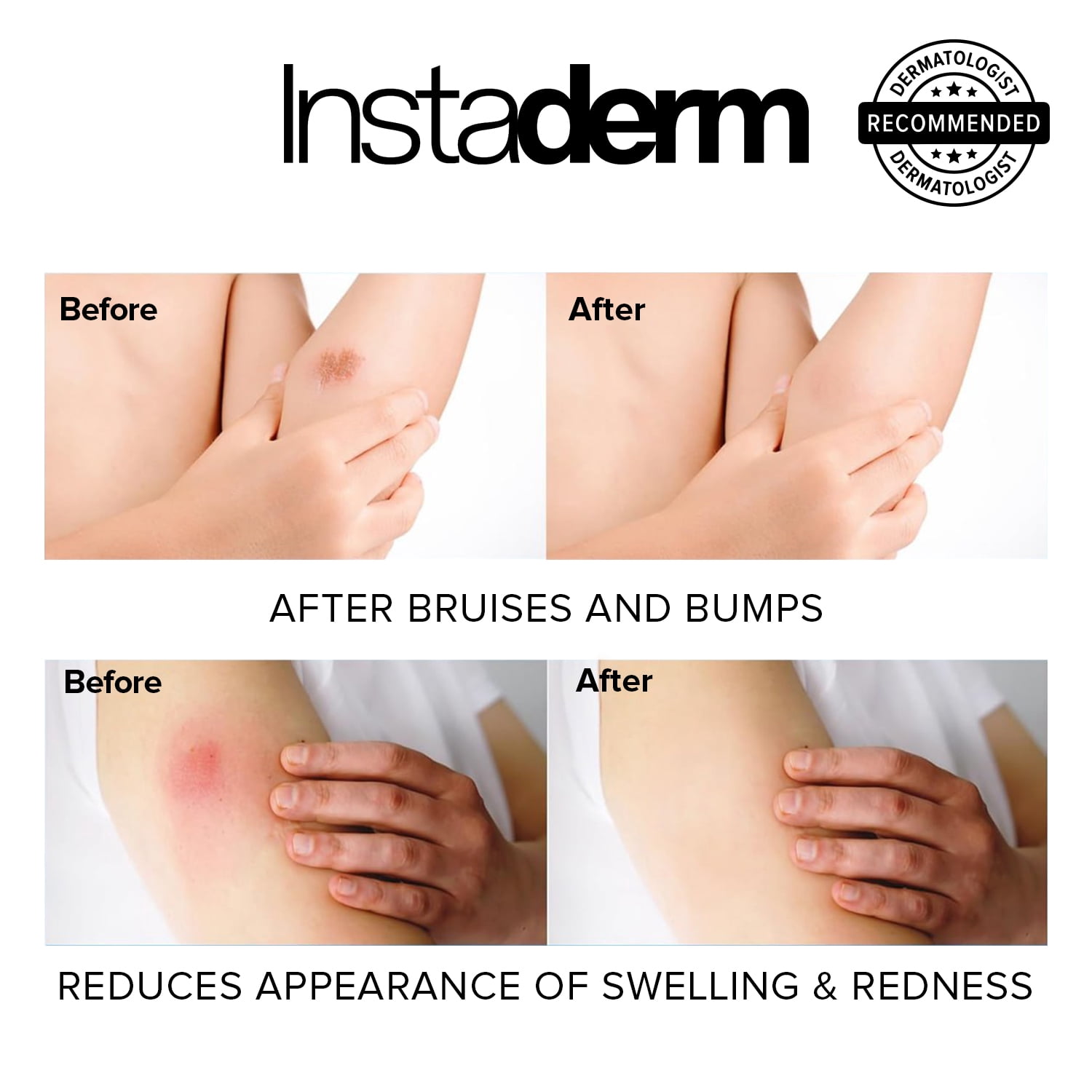 Vitamin K Cream- Bruise Healing Formula with Arnica. Dark Spot Moisturizer for Bruising, Spider Veins & Broken Capillaries. Repair Under Eye Dark Circles, Fine Lines, Puffiness, Wrinkles Face & Body.