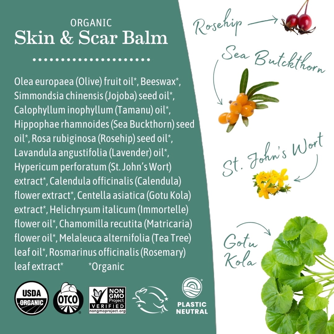Earth Mama Organic Skin and Scar Balm for C-Section Scars and Stretch Marks, 1 fl oz