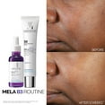 LaRochePosay Mela B3 Serum, Dark Spot Corrector With AntiAging Melasyl + 10 Niacinamide