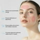 thumbnail image 3 of Mascarilla facial de fototerapia Facego 7 colores inalámbrica para mujer, 3 of 7