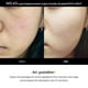 thumbnail image 2 of Vaso Skin Glow Booster CELORABY Potension Penta-Shot, 2 of 8