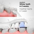 thumbnail image 5 of AquaSonic Home Dental Center PRO - Electric Power Toothbrush & Water Flosser, Black Series Pro+Oral Irrigator – ADA Approved (White), 5 of 6
