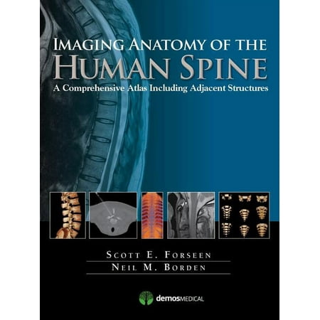 UPC: 9781936287826 | Imaging Anatomy of the Human Spine: A Comprehensive Atlas Including Adjacent Structures (Hardcover)