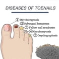 thumbnail image 3 of 96pcs Anti Fungal Nail Treatment-toe-fungus Onychomycosis Repair Sticker -, 3 of 5