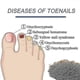 thumbnail image 3 of 96pcs Anti Fungal Nail Treatment-toe-fungus Onychomycosis Repair Sticker -, 3 of 5