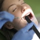 thumbnail image 3 of ColoMX 25 uds depresor de lengua de plástico espátulas depresores de lengua Dental raspador de lengua para cuidado bucal, 3 of 7