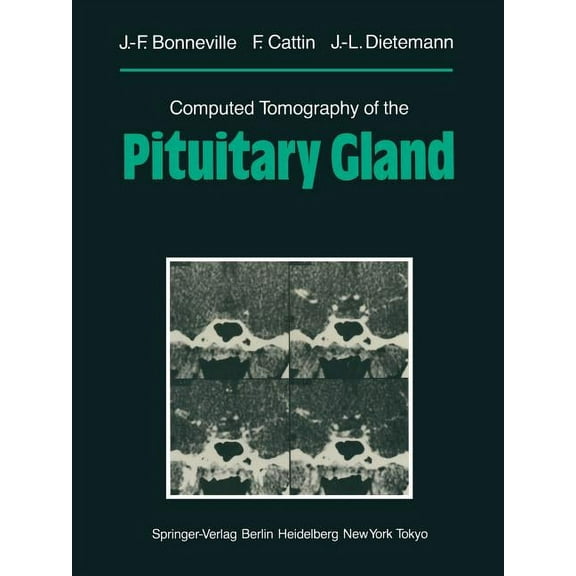 Computed Tomography of the Pituitary Gland: With a Chapter on Magnetic Resonance Imaging of the Sellar and Juxtasellar R, (Paperback)