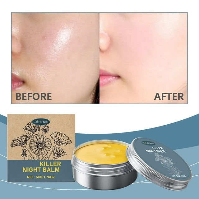 Fiudx Ofertas Y Liquidación La Crema Hidratante Y Eliminadora Utiliza Un Aceite Para La Piel Suave Y Eficaz Que Reduce La formación Y La Frescura De La Piel 50G