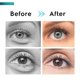 thumbnail image 5 of Crema para contorno de ojos OSNOIA para ojeras e hinchazón, 5 of 7