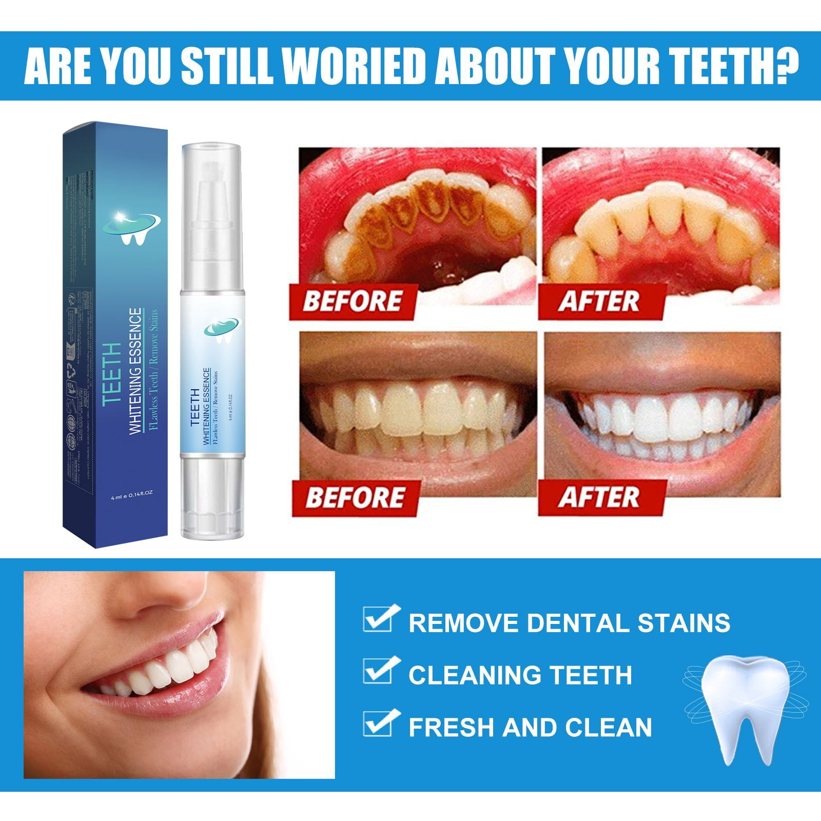 Alvantor Teeth Whitening Pen for Deep Cleaning, Stain Removal, Plaque Cleaning, Fresh Breath, 0.14 fl. oz