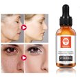 thumbnail image 1 of Suero hidratante blanqueador para eliminar las manchas de pecas - 30 ml, 1 of 8