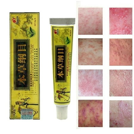 Archer 15ml Herbal Cream Psoriasis Dermatitis Eczema Pruritus Treatment ...