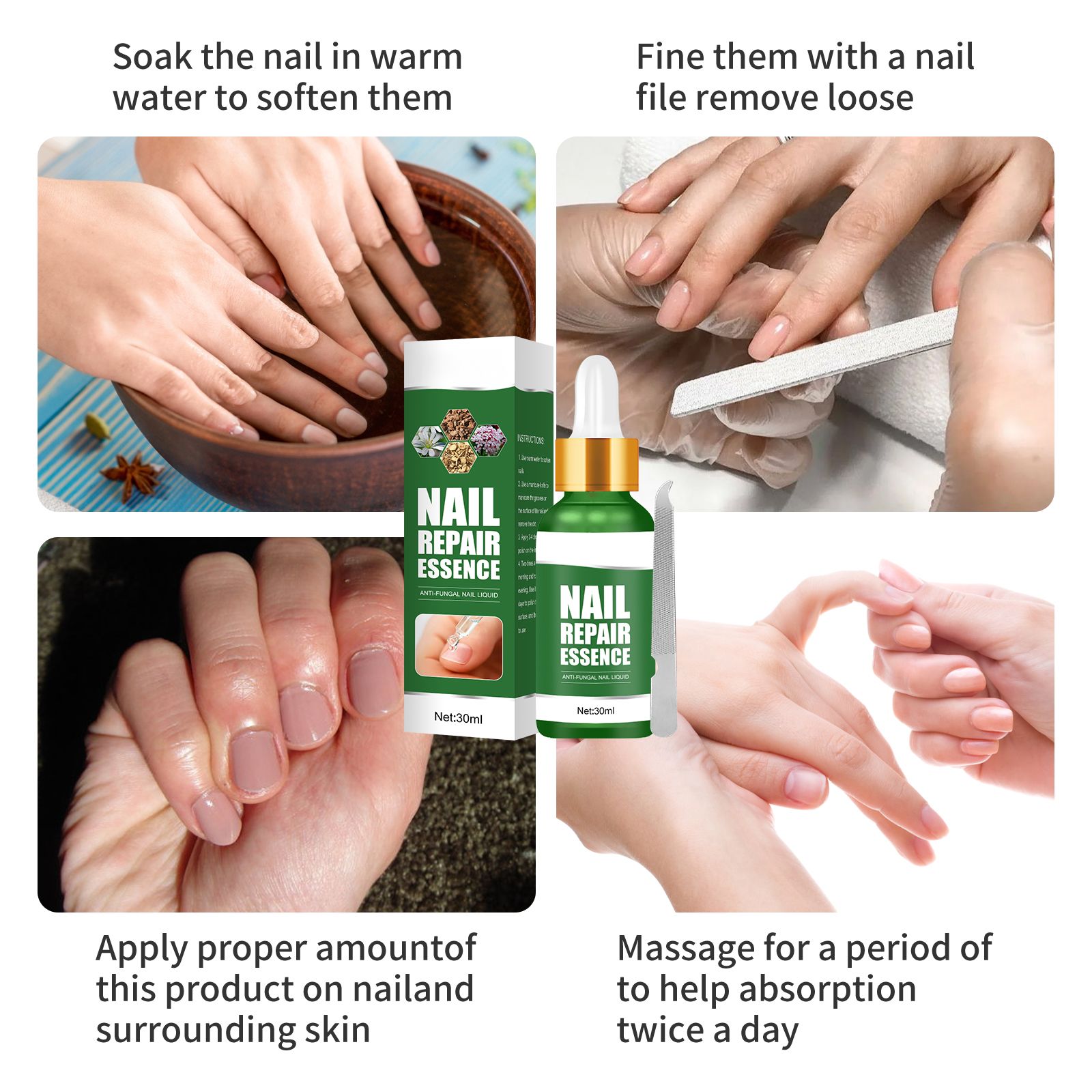 Alvantor Toenail Fungus Treatment Serum - Nail Repair Essence, 1.01 fl oz