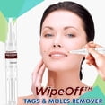 thumbnail image 1 of Eliminador de verrugas líquidas para quitar lunares, 3ml, pluma Genital Ygjytge Cuidado Belleza, 1 of 3