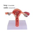 thumbnail image 3 of Female Uterus Structure Biological Models Educational Experiment, 3 of 4