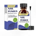 thumbnail image 1 of Powerful Nail Fungus Solution - 30ml Toenail Repair Treatment for Stronger, Healthier Nails, 1 of 5