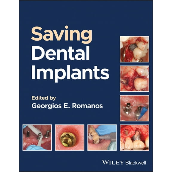 Saving Dental Implants (Hardcover)