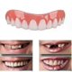 thumbnail image 1 of 2 Sets Of Dentures, Upper And Lower Jaw Dentures, Natural And Comfortable, Protect The Teeth, And Regain A Confident Smile-hyj, 1 of 3