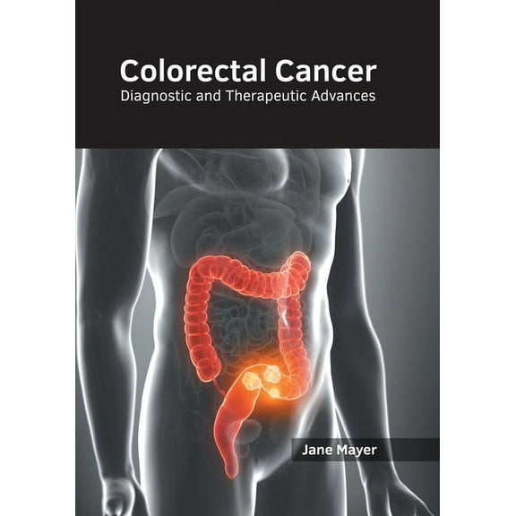 Colorectal Cancer: Diagnostic and Therapeutic Advances, (Hardcover)