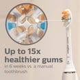 thumbnail image 2 of A3 Premium All-in-One Replacement Toothbrush Heads Compatible with Philips Sonicare Replacement Toothbrush Heads,4 Brush Heads, White, 2 of 5