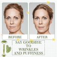 thumbnail image 5 of Gua Sha and Jade Roller Set for Daily Skin Care, Gua Sha Tools for Face, Neck and Body Muscles-2025, 5 of 5