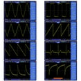 thumbnail image 2 of Contador de frecuencia del generador de señal de función FG-200 DDS 0,01 Hz - 500 KHz, 2 of 6