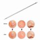 thumbnail image 1 of Acne Pimple Patch Invisible Acne Stickers Effectively Remove Pimples Acne Treatment, 1 of 5