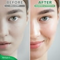 thumbnail image 6 of Vitamin C Serum(2 Pack), Powerful Antioxidant for Skin Brightening Anti Aging Hydrating Serum by Nysa-9, 6 of 10