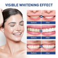 thumbnail image 3 of Jaysuing De Los Dientes Pluma De Limpieza De Dientes Para Eliminar La Suciedad De Los Dientes Amarillos Blanqueamiento De Dientes Pluma De Limpieza Oral |, 3 of 5