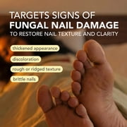 Kerasal Nighttime Renewal Fungal Nail Patch, Extra Strength, Overnight Repair, 14 Count