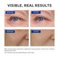 thumbnail image 3 of Sérum SKINERSE Retinol para rostro antienvejecimiento con vitamina E 30 ml, 3 of 9