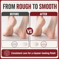 thumbnail image 6 of Double-Sided Foot Scraper for Callus Removal, Stainless Steel Foot File Tool, Arc-Shaped Dead Skin Remover for Rough Feet, Cracked Heels & Pedicure Care, White+2*filer, 6 of 9