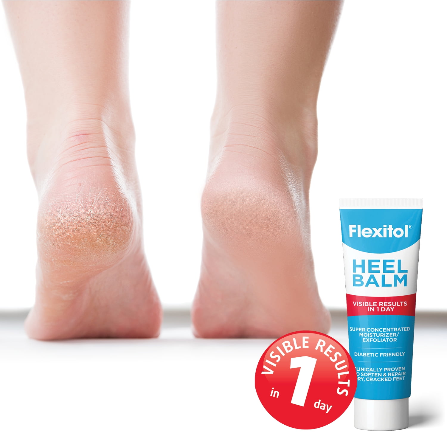 Flexitol Heel Balm Super-Concentrated Moisturizer & Exfoliator Diabeti