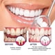 thumbnail image 3 of West & Month Gum Care Foam Mousse Cleaning Tooth Stains Dirt Care Oral White Tooth Toothpaste, 3 of 4