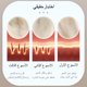 thumbnail image 5 of Depiladora láser IPL MLAY T14, depiladora láser con refrigeración por hielo, depiladora láser para cara y cuerpo para mujeres, depilación con lámpara reemplazable, 5 of 5