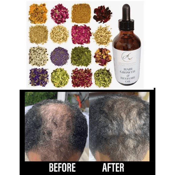 Herbs Hair Growth Herbs Hair Growth