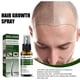 thumbnail image 5 of Spray Nutritivo y Crecimiento Rápido Del Cabello Hot6sl 50 ml, 5 of 7