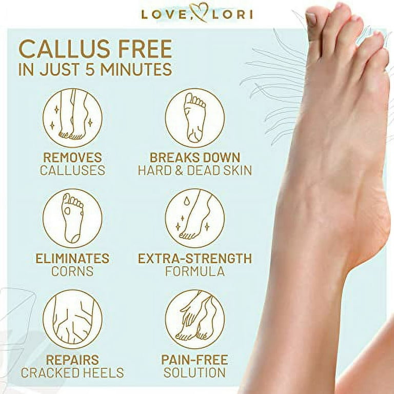 Foot Callus Remover Gel 6oz by Love, Lori - Callus Remover for Feet & Dead  Skin