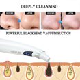 thumbnail image 3 of Guardurnaity Cuidado de la piel Removedor de espinillas Belleza facial inteligente Limpieza de poros 5 engranajes Instrumentos ajustables para Cuerpo del baño, 3 of 6