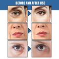 thumbnail image 2 of Crema antiarrugas instantánea que levanta y reduce la hinchazón de los ojos y las arrugas, repone el agua, crema antiedad y antiarrugas"22PCS" Fivean LED, 2 of 2
