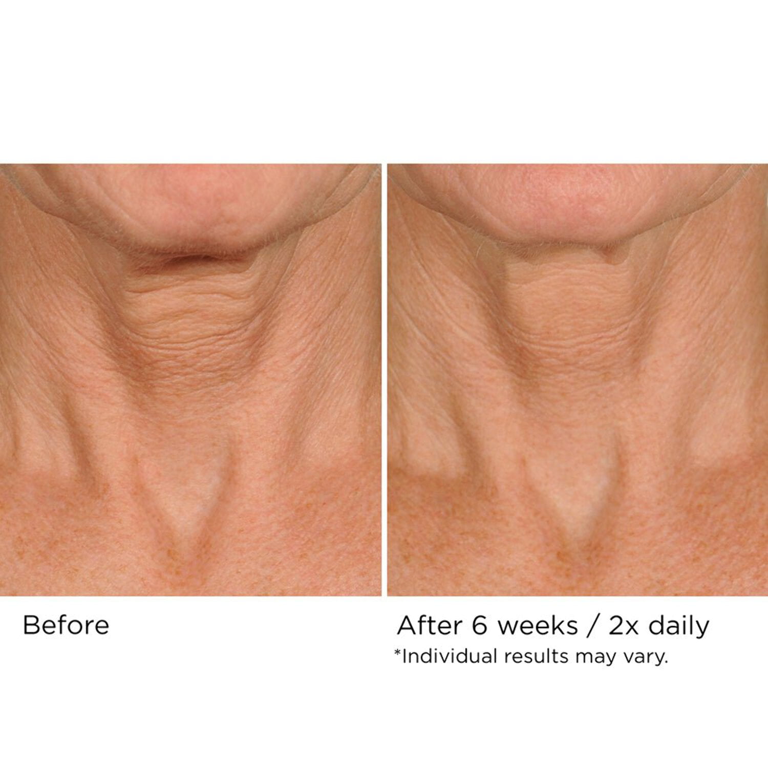 Deco-Lift Neck  Decollete Firming  Lifting Complex 1.7 oz