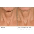 thumbnail image 5 of Deco-Lift Neck  Decollete Firming  Lifting Complex 1.7 oz, 5 of 8