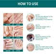 Nail Fungus Treatment for Toenail, Effective Toenail Fungus Treatment(00)