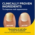 thumbnail image 5 of Dr. Scholl's Anti Fungal Nail Treatment Revitalizer Kit with LED Light-Activated Therapy, 1 Kit, 5 of 11