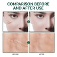 thumbnail image 3 of Silicone Scar Gel - Medical Scar Gel Gentle Formula 50ml, 3 of 4