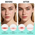 thumbnail image 6 of Pimple Patches for Face, Hydrocolloid Acne Patches, Star Zit Covers, Black Superstar Patches Spot Stickers, 102 Count | 4 Sizes (8mm/9mm/11mm/14mm), 6 of 7