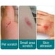 thumbnail image 5 of Vendaje Líquida Impermeable Sellos Cinta Adhesiva de para Vendaje Invisible de Vendaje Botiquín de Primeros, 5 of 9