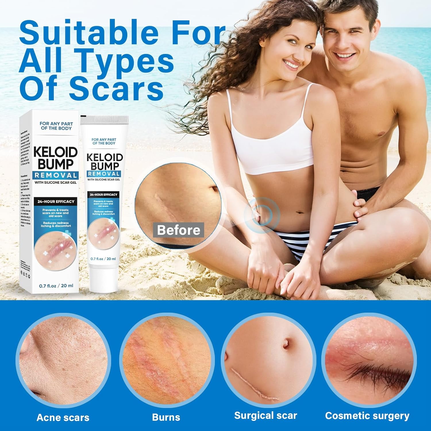 Keloid Bump Removal Gel. Silicone Scar Treatment - Professional Scar Cream for Old & New Scars - 20ml
