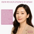 thumbnail image 2 of Parche Antiarrugas Facial OLLM para Frente para Mujeres de 25-35 Años, 2 of 7