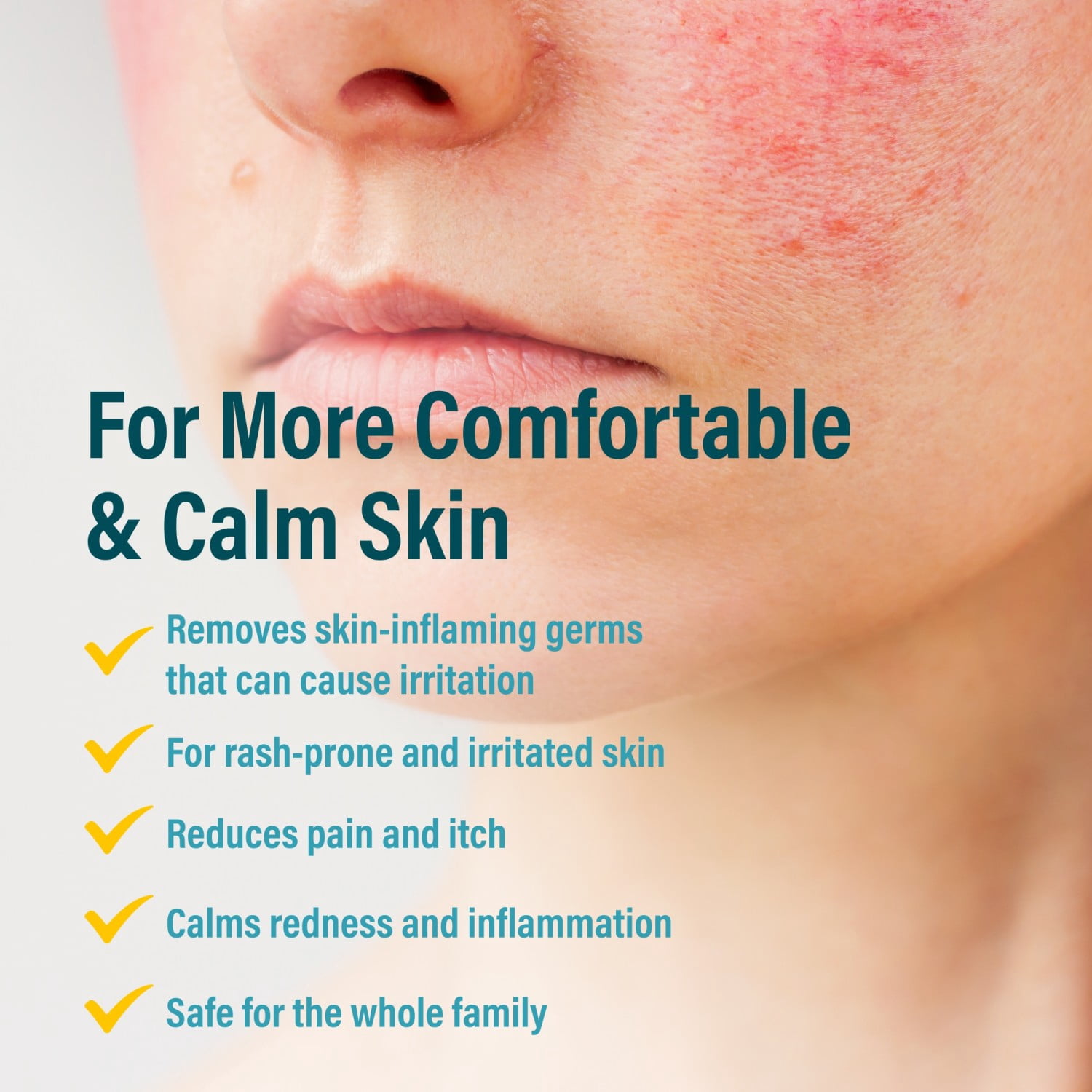 A+D Advanced Dermatitis Care Hydrogel Spray with Hypochlorous Acid 4 oz